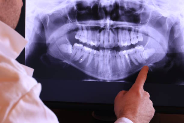 Best Emergency Dentist for Lost Fillings or Crowns in Harrison, TN