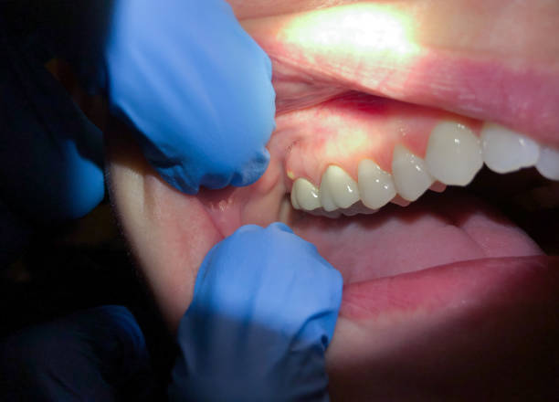 Best Emergency Dentist for Special Needs Patients in Harrison, TN